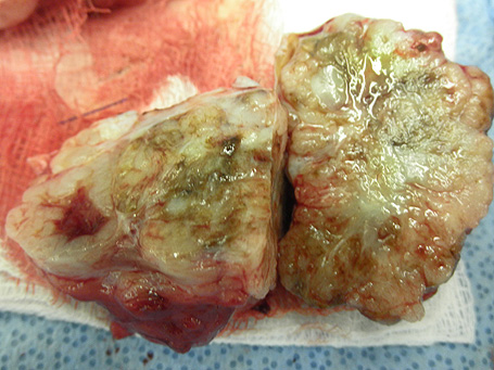 Mammary Tumor